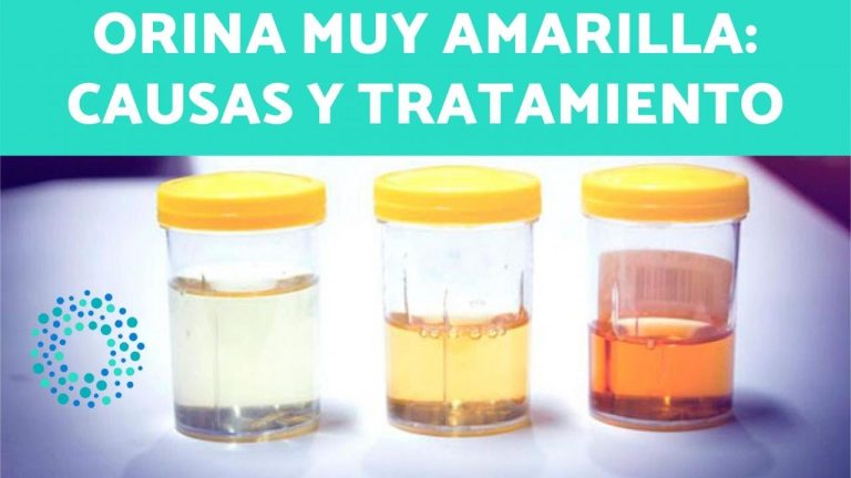 Descubren el impactante fen&oacute;meno de la orina amarilla fluorescente